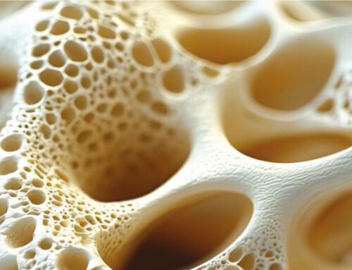 Densitometria Ossea: guida all’interpretazione